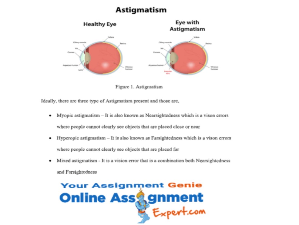 ophthalmic assignment sample